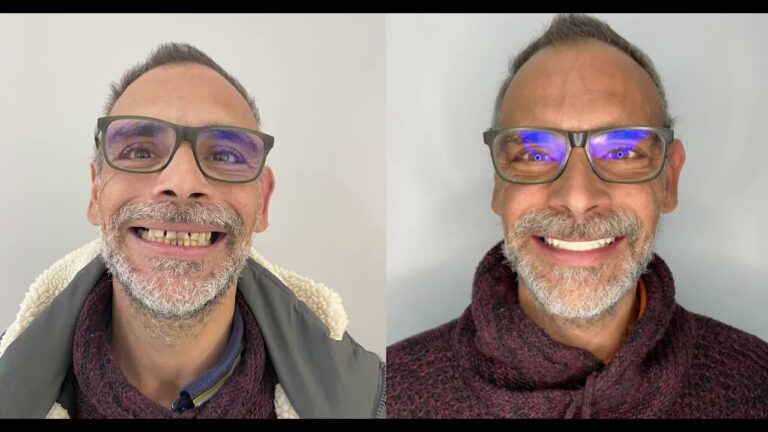 Costo panoramica dentale ospedale: tutto quello che devi sapere