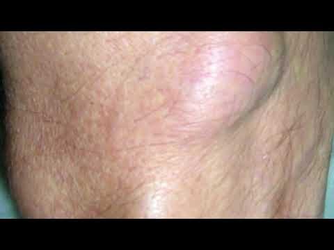 Compenso per Chirurgia Ambulatoriale: Cosa Aspettarsi